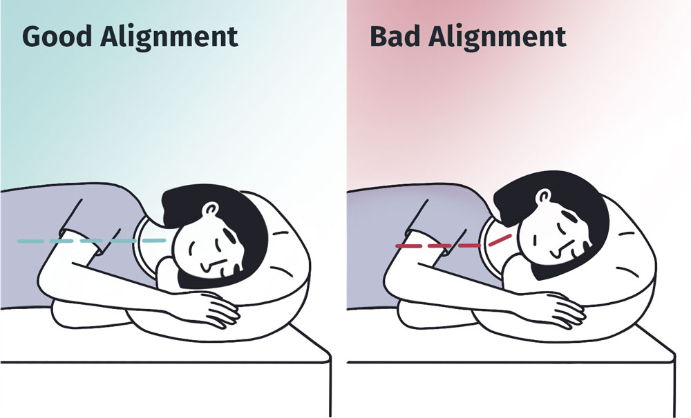 A graphic depicting the correct and incorrect alignment for side sleeping.